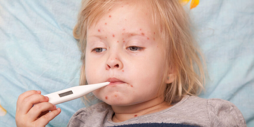 За останній тиждень на Вінниччині випадків захворювання на кір не зафіксовано