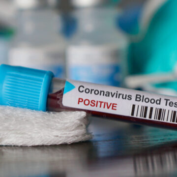 Коронавірус: у разі потреби на Вінниччині розгорнуть ще 200 інфекційних ліжок