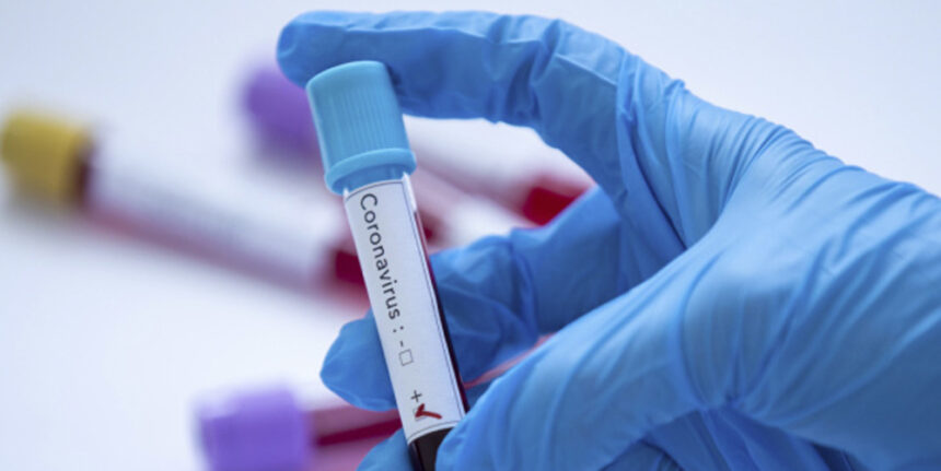 Covid-19: у Вінницькій області вперше виявили коронавірус у 55 осіб