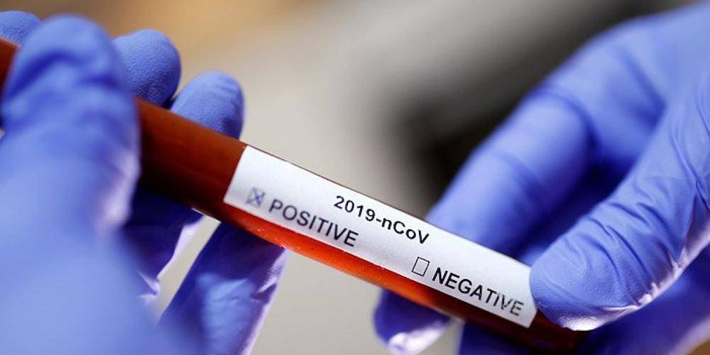 Станом на 15 квітня у Вінниці 105 випадків коронавірусу, в т.ч. у шести дітей