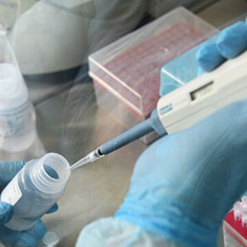 Коронавірус підтвердили у пацієнтки Жмеринської лікарні: 16 лікарів на обсервації