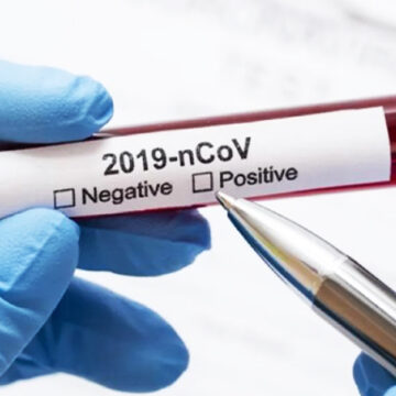 Вінницька область не подала інформації щодо тестування на коронавірус