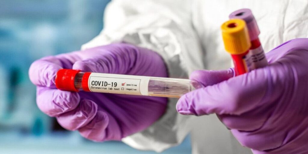 COVID-19 у Вінниці: 51 хворий, серед них 23 медпрацівники