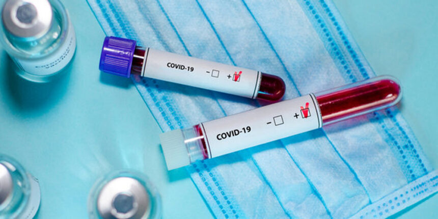 У Хмільницькому районі на коронавірус захворіли мати та донька