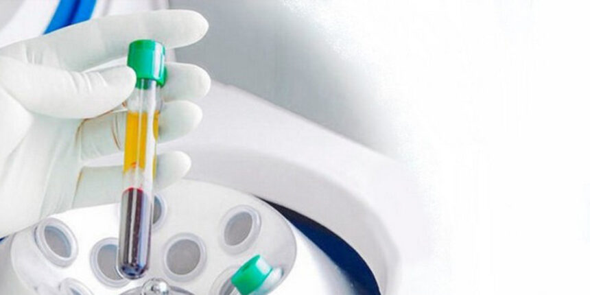 На Вінниччині COVID-19 виявили у 427 випадках