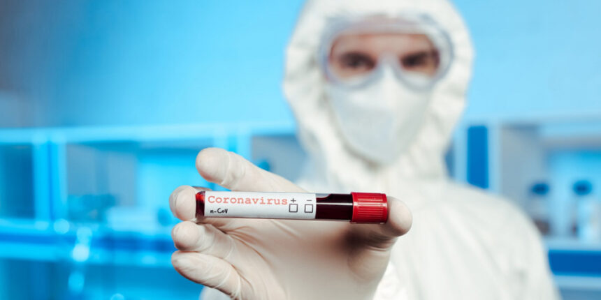 У Вінниці станом на ранок 3 червня - 613 випадків COVID-19, з них 378 вже одужали