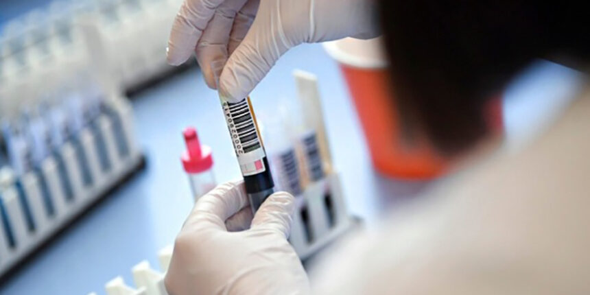 Коронавірус: 22 нових випадки за добу