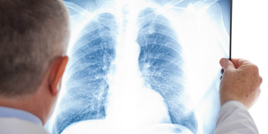 У Вінниці станом на 30 червня зареєстровано 1079 випадків COVID-19