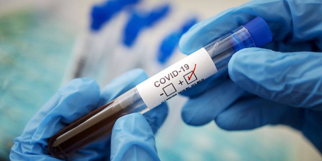 COVID-19: на Вінниччині зареєстрували ще 51 випадок інфікування