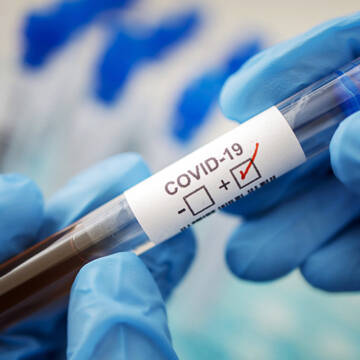 COVID-19: на Вінниччині зареєстрували ще 51 випадок інфікування