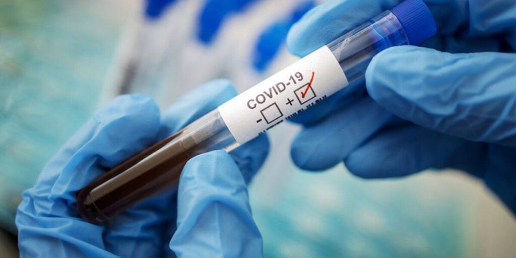 Станом на 24 жовтня на Вінниччині виявлено 9081 хворих на COVID-19
