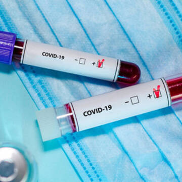 COVID-19: На Вінниччині 135 нових випадків інфікування