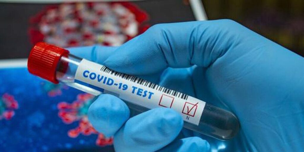 COVID-19: на Вінниччині впродовж доби померло 4 людини