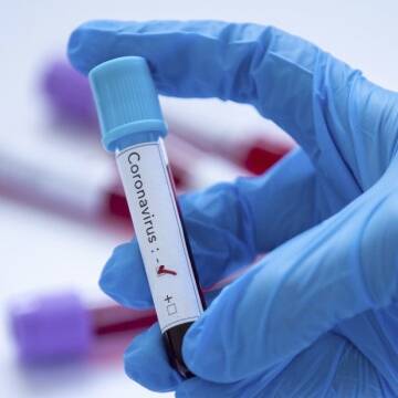 За останню добу на Вінниччині від коронавірусу одужали 270 осіб