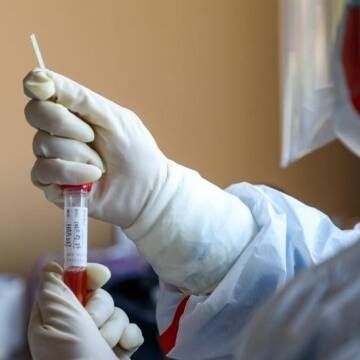 На Вінниччині коронавірусна інфекція підтвердилася у 102 хворих