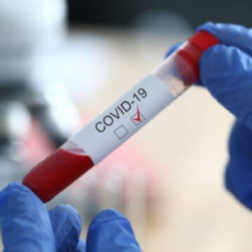 На Вінниччині зафіксували антирекорд по кількості хворих на коронавірус за добу