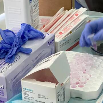 У суботу на Вінниччині позитивний тест на коронавірус отримали 482 людини
