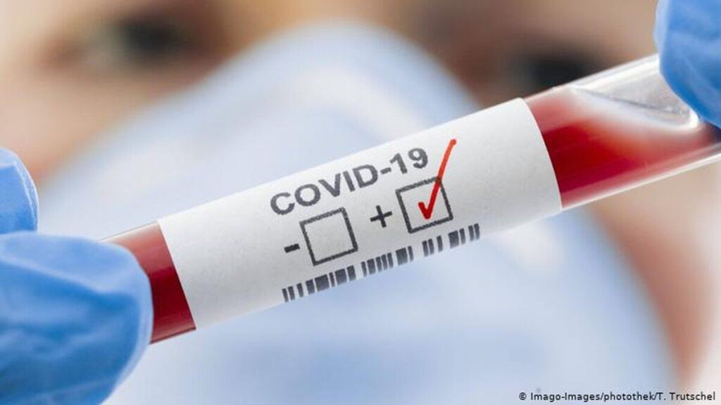 На Вінниччині зафіксовано 141 новий випадок COVID-19