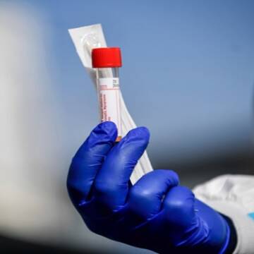 На Вінниччині від коронавірусу за добу одужало 134 людини