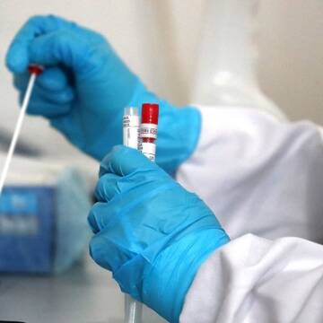 На Вінниччині не зафіксовано смертей від коронавірусу