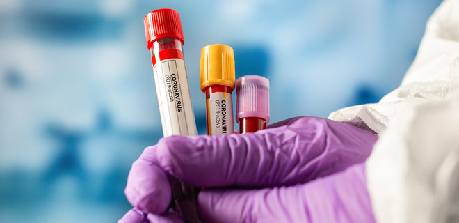 На Вінниччині зафіксовано 7 нових випадків коронавірусу