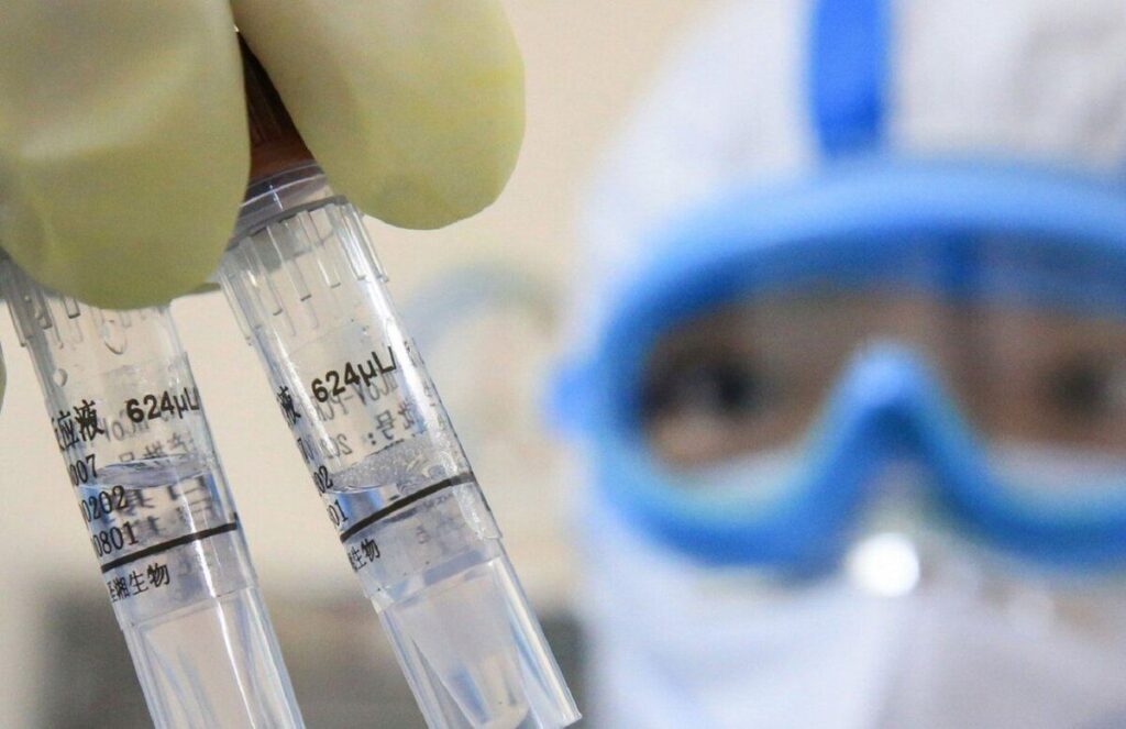 COVID-19: на Вінниччині зафіксовано 13 нових випадків
