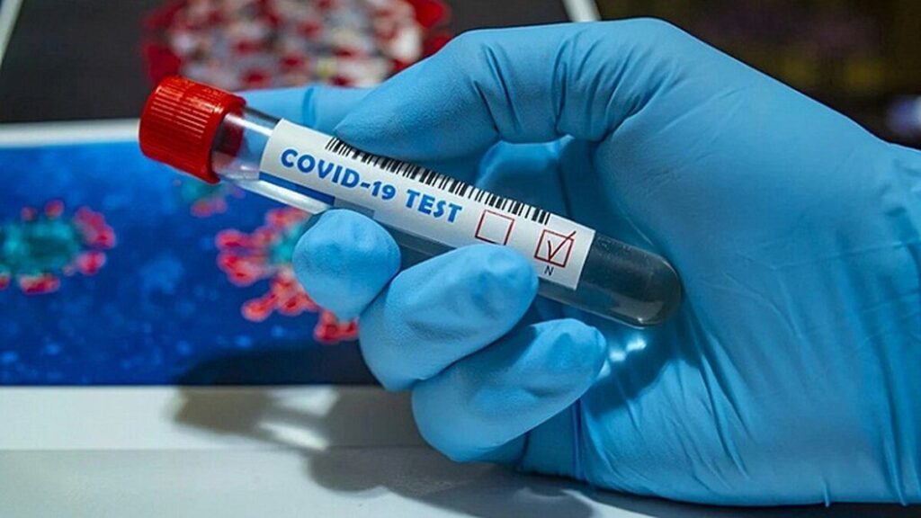 На Вінниччині зареєстровано 208 хворих на COVID-19