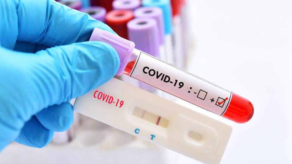 Вінниччина в “червоній”. За добу 929 нових випадків хворих на COVID-19