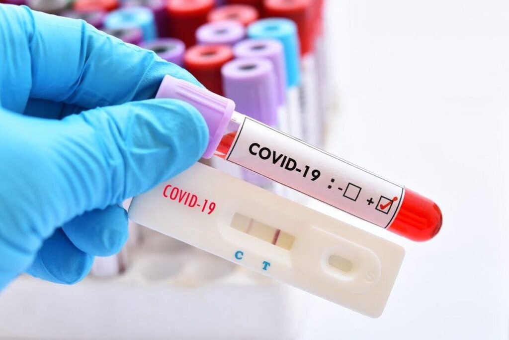 Вінниччина в “червоній”. За добу 929 нових випадків хворих на COVID-19