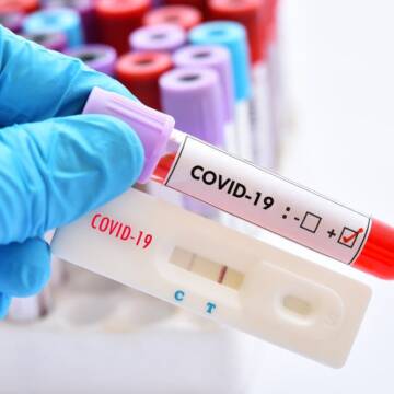 Вінниччина в “червоній”. За добу 929 нових випадків хворих на COVID-19