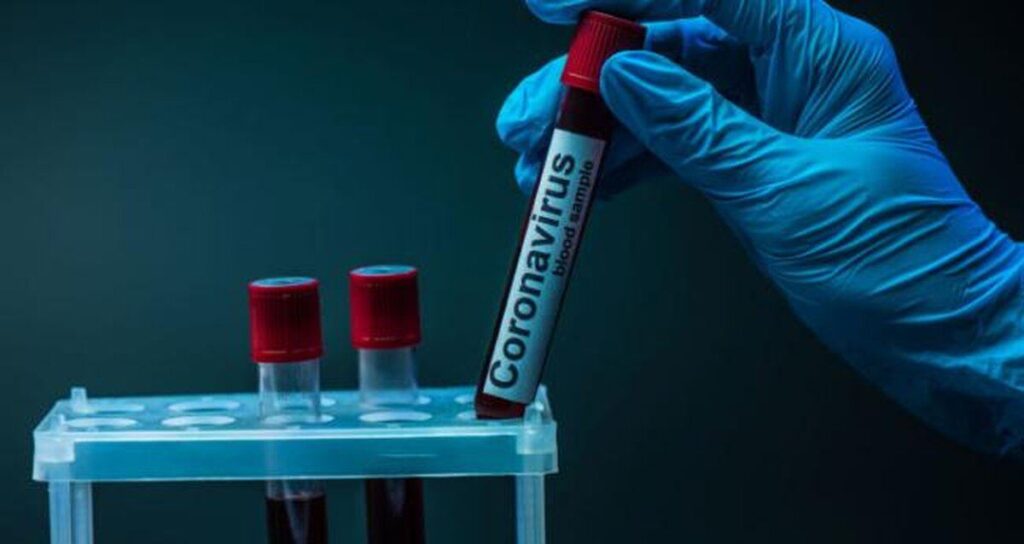 У Північній Кореї офіційно зареєстрували перший випадок COVID-19
