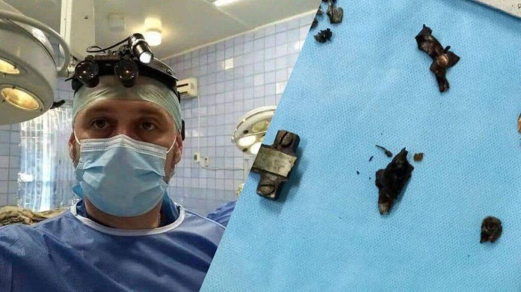 Вінницький військовий хірург успішно провів операцію, яка немає аналогів у світі