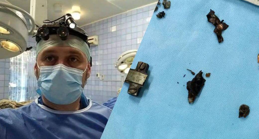 Вінницький військовий хірург успішно провів операцію, яка немає аналогів у світі