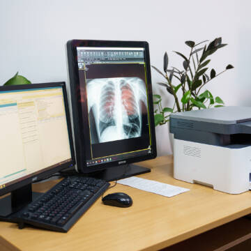 Вінницька лікарня ШМД отримала сучасний рентген-монітор з Бельгії