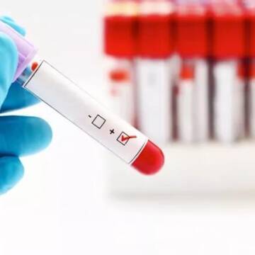 У ЦПМСД Вінниці проводять тестування на всі види гепатиту