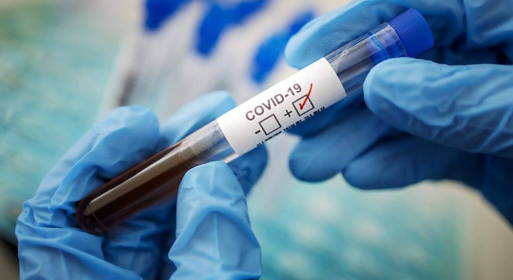 У вінницьких закладах охорони здоров’я можна безкоштовно здати тест на COVID-19