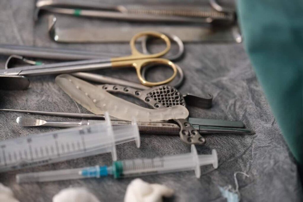У Вінниці виконали унікальну операцію з відновлення нижньої щелепи із застосуванням 3D-технологій