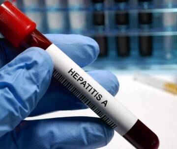 Кількість хворих на гепатит А у Вінниці – зростає
