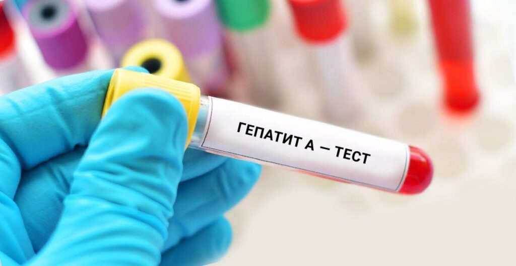 На Вінниччині за добу 15 підтверджених випадків гепатиту А