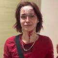 Під час комендантської години в Одесі побили дівчину: в ТЦК відреагували на звинувачення