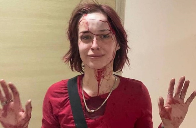 Під час комендантської години в Одесі побили дівчину: в ТЦК відреагували на звинувачення