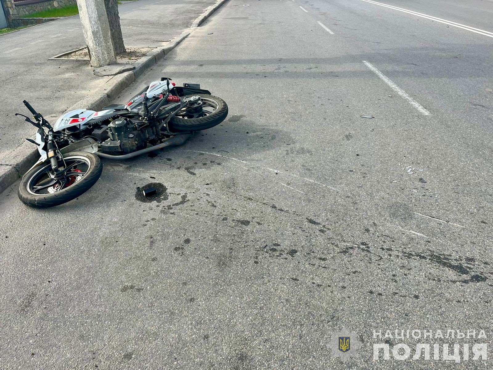 На Вінниччині внаслідок ДТП постраждали троє мотоциклістів