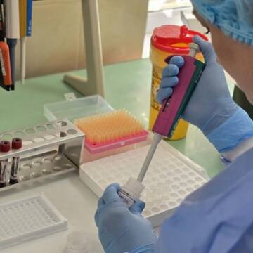На Вінниччині фіксують зростання захворюваності на кір