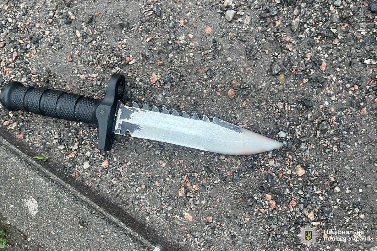 У Вінниці чоловік після випадкового знайомства вдарив ножем нового товариша