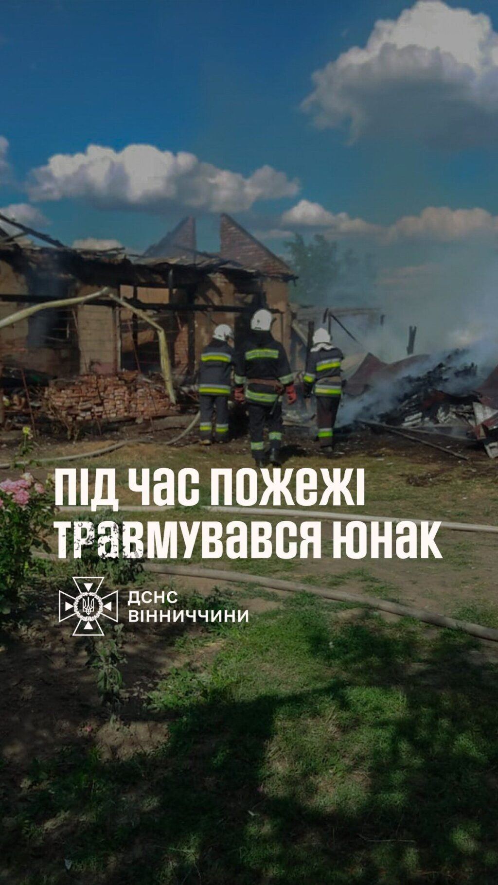 Підліток отримав опіки під час пожежі на Вінниччині
