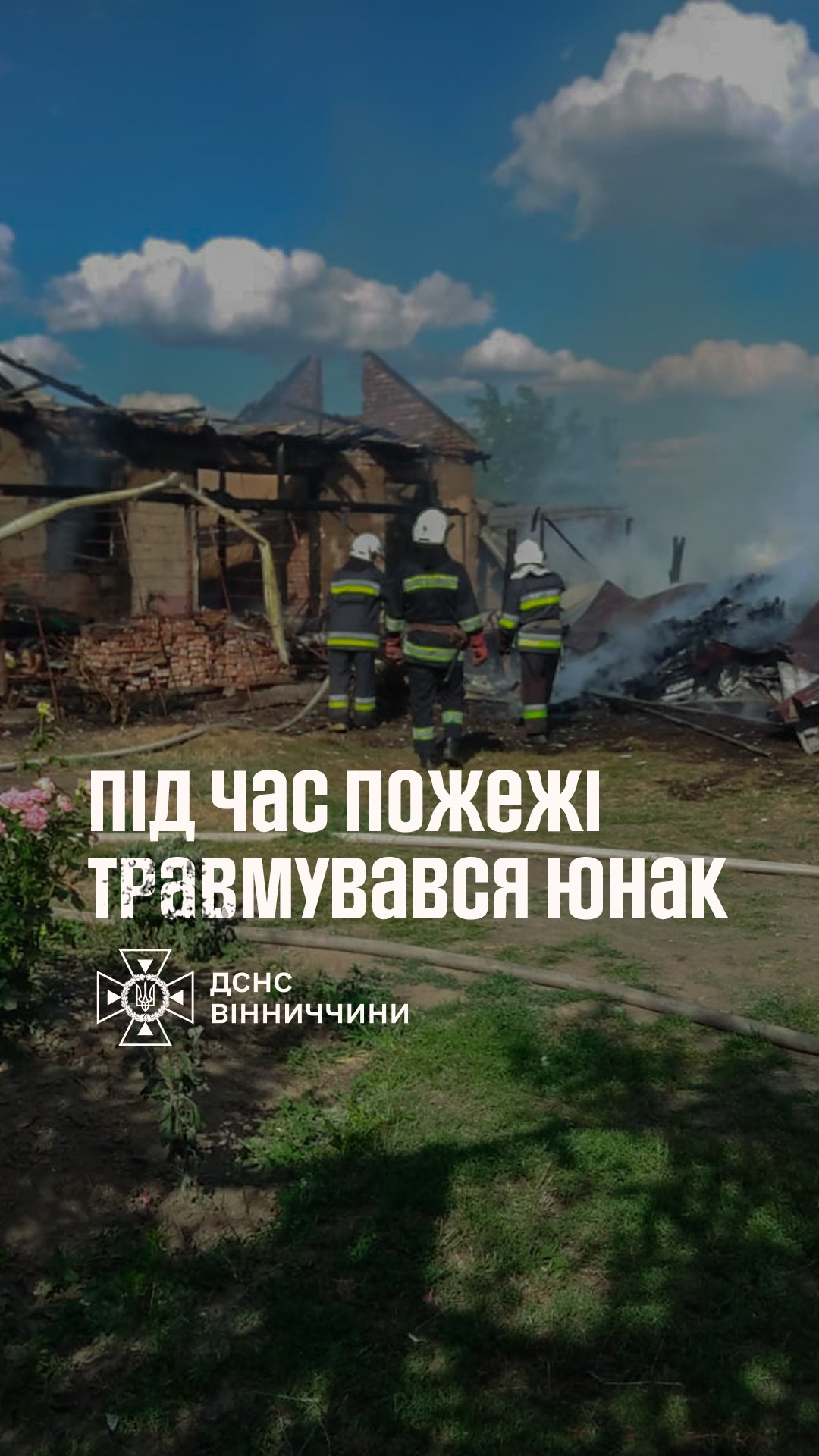 Підліток отримав опіки під час пожежі на Вінниччині