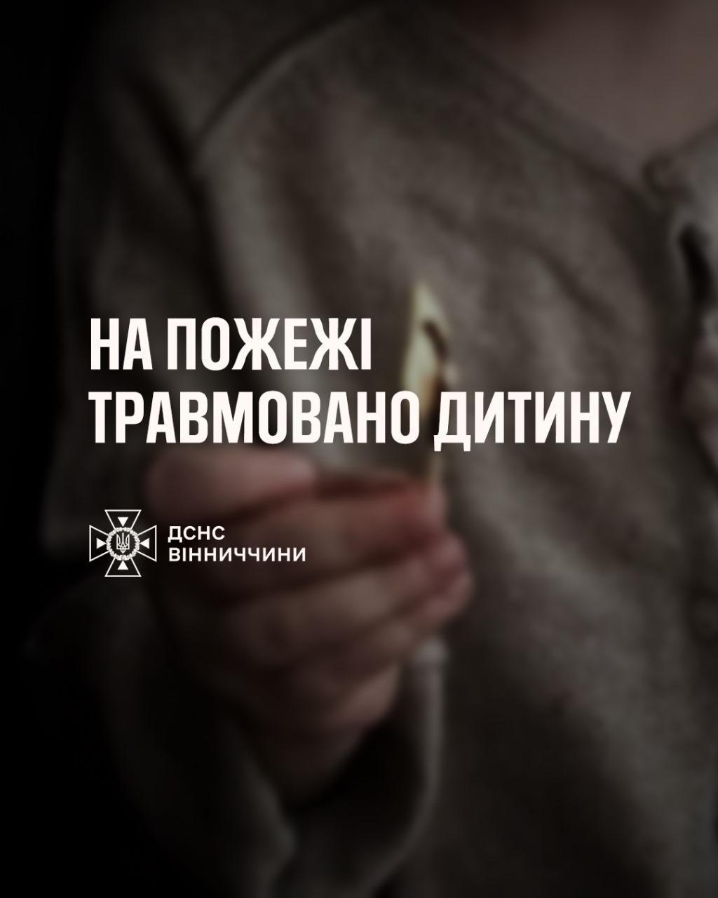 На Вінниччині п’ятирічна дівчинка отримала опіки через пустощі з вогнем