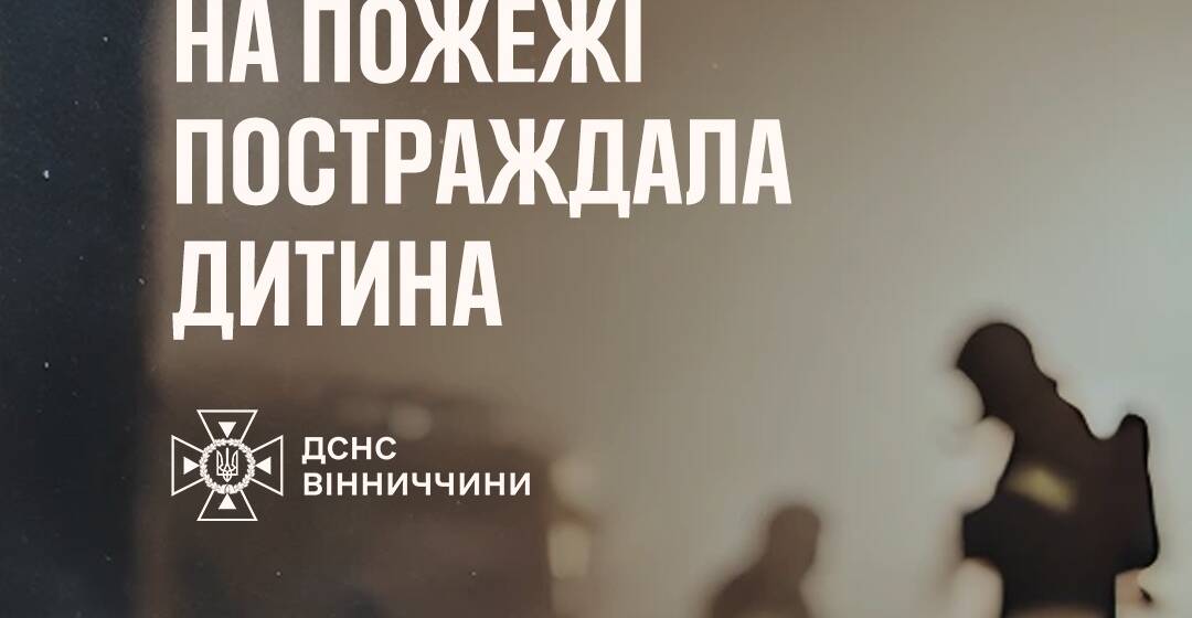 У Жмеринці під час пожежі травмувався 15-річний юнак