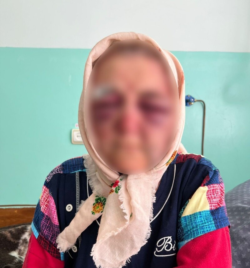 На Вінниччині раніше судимий чоловік вимагав гроші у 87-річної сусідки