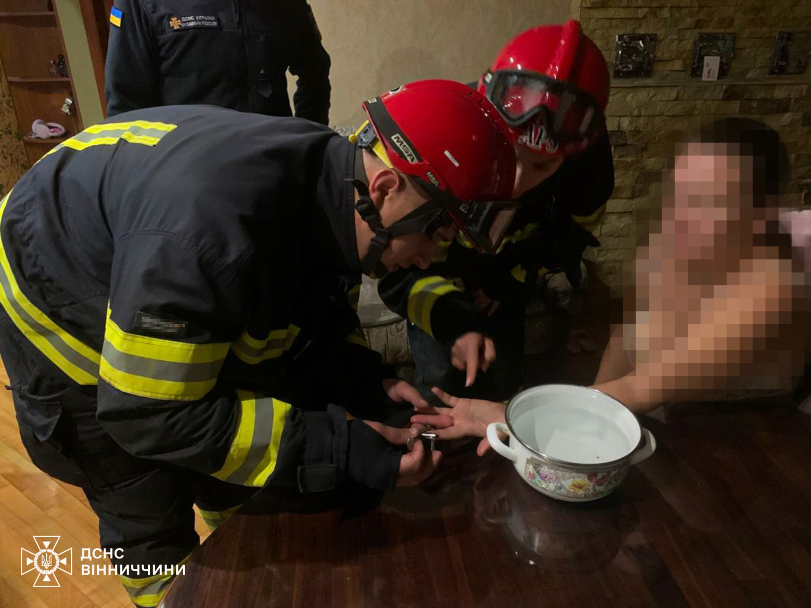 У Вінниці обручка стала пасткою: рятувальники знімали її з пальця жінки